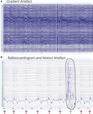 Artifact Reduction in Simultaneous EEG-fMRI: A Systematic Review of Methods and Contemporary Usage